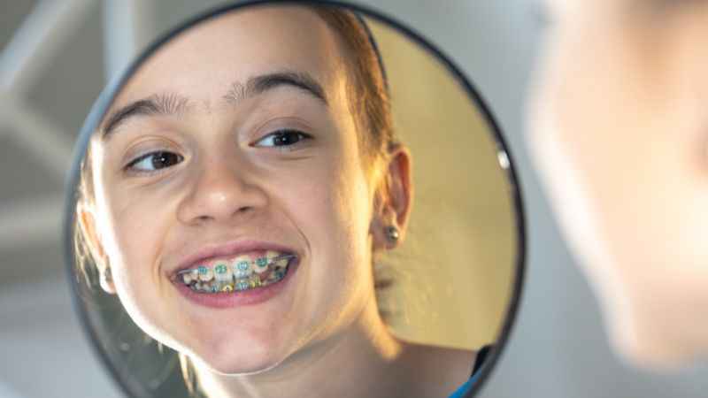 baby blue braces color