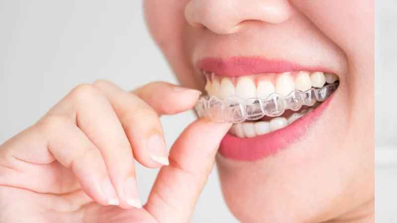 Clear Braces for Teenager