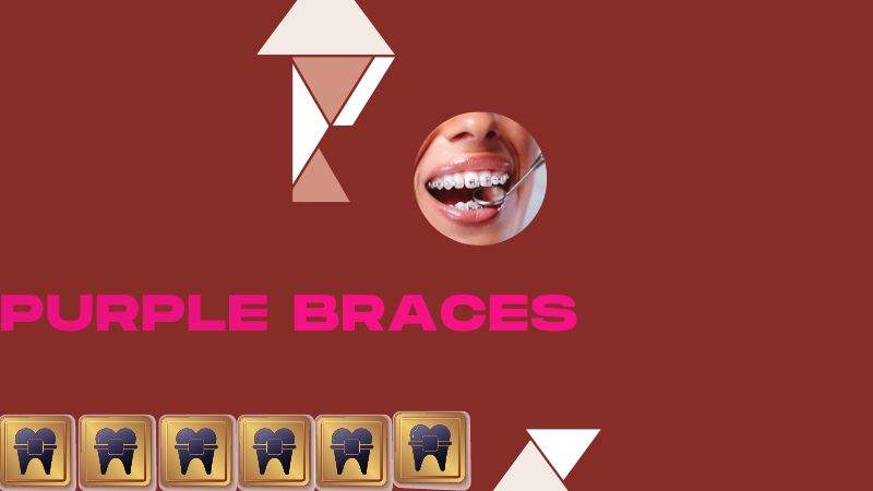 purple braces